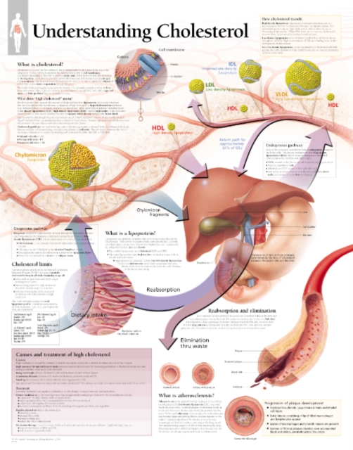 Understanding Cholesterol Laminated Poster, Poster Book