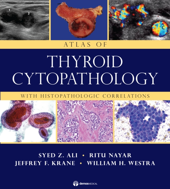 Atlas of Thyroid Cytopathology : With Histopathologic Correlations, Hardback Book