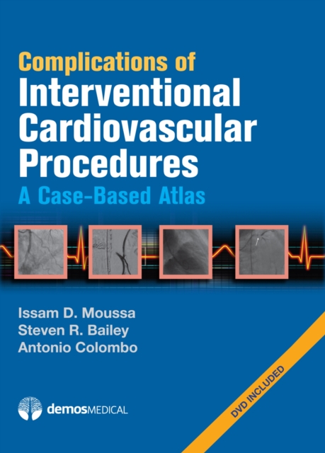 Complications of Interventional Cardiovascular Procedures : A Case-Based Atlas, Hardback Book