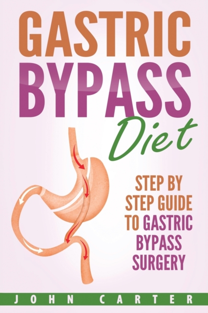 Gastric Bypass Diet : Step By Step Guide to Gastric Bypass Surgery, Paperback / softback Book