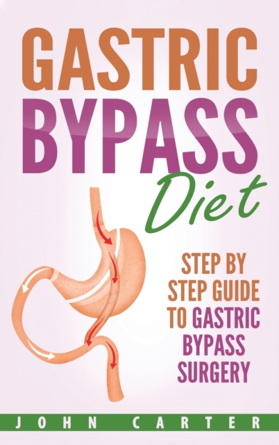 Gastric Bypass Diet : Step By Step Guide to Gastric Bypass Surgery, Hardback Book