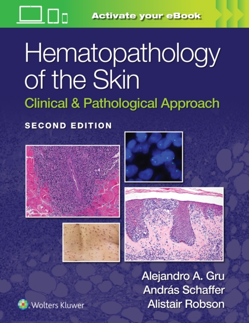 Hematopathology of the Skin : Clinical & Pathological Approach, Hardback Book