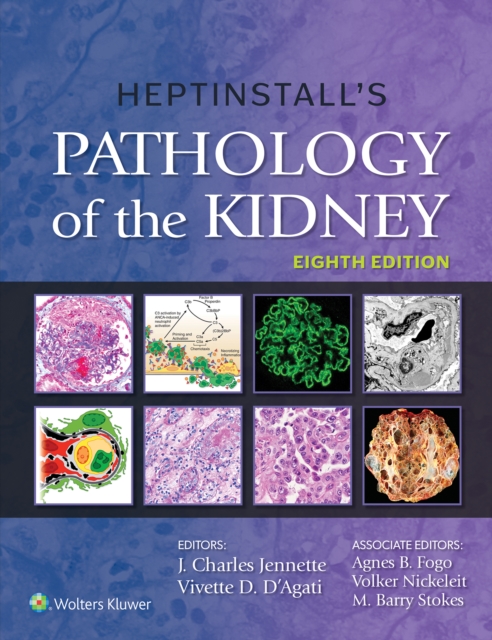 Heptinstall's Pathology of the Kidney, EPUB eBook
