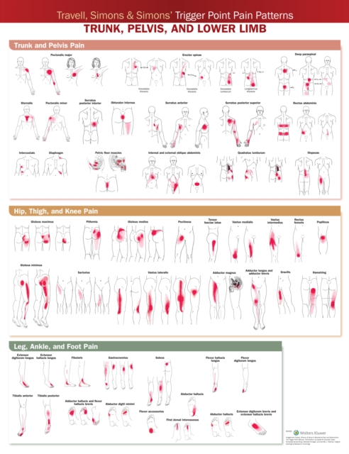 Travell, Simons & Simons’ Trigger Point Pain Patterns Wall Chart : Trunk, Pelvis, and Lower Limb, Wallchart Book