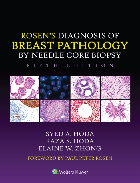Rosen's Diagnosis of Breast Pathology by Needle Core Biopsy, EPUB eBook