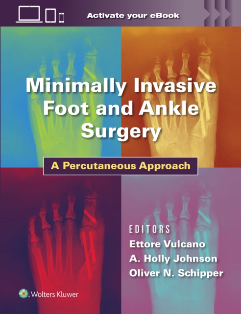 Minimally Invasive Foot and Ankle Surgery : A Percutaneous Approach, Hardback Book