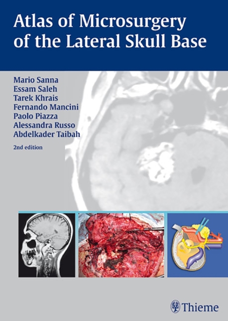 Atlas of Microsurgery of the Lateral Skull Base, Hardback Book