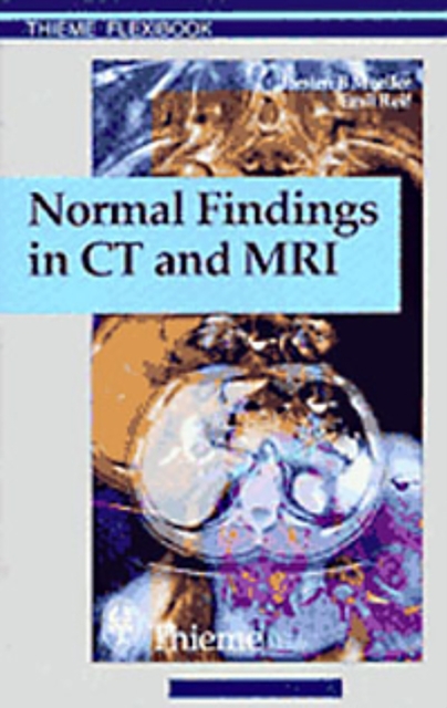 Normal Findings in CT and MRI, A1, print, Paperback / softback Book
