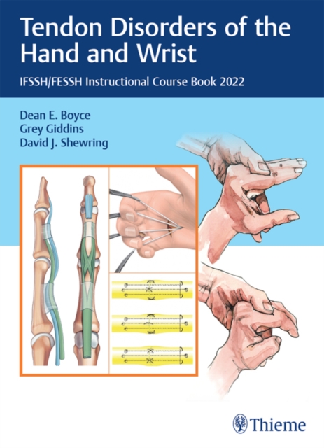 Tendon Disorders of the Hand and Wrist : IFSSH/FESSH Instructional Course Book 2022, EPUB eBook