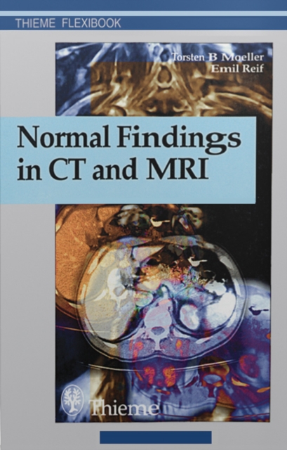 Normal Findings in CT and MRI, EPUB eBook