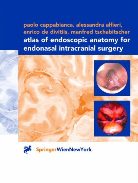 Atlas of Endoscopic Anatomy for Endonasal Intracranial Surgery, Hardback Book