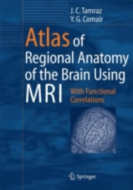 Atlas of Regional Anatomy of the Brain Using MRI : With Functional Correlations, PDF eBook
