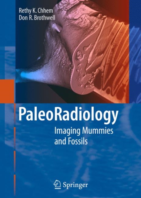 Paleoradiology : Imaging Mummies and Fossils, Hardback Book