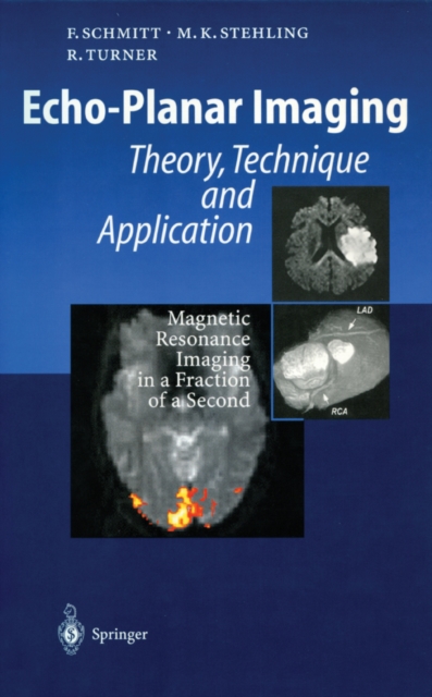 Echo-Planar Imaging : Theory, Technique and Application, PDF eBook