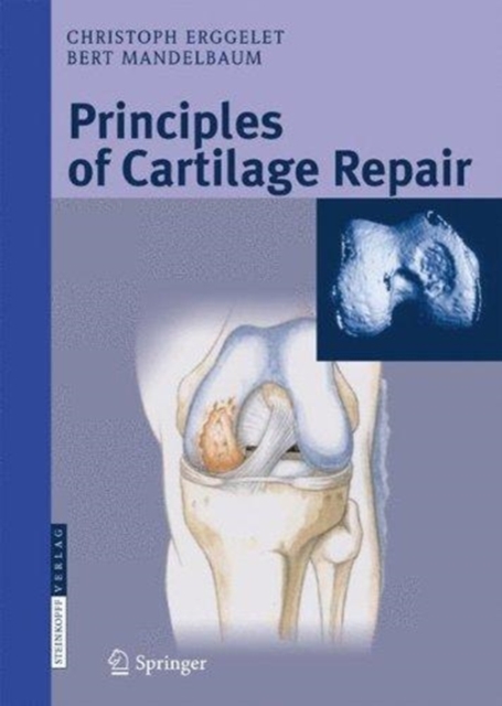 Principles of Cartilage Repair, Paperback / softback Book