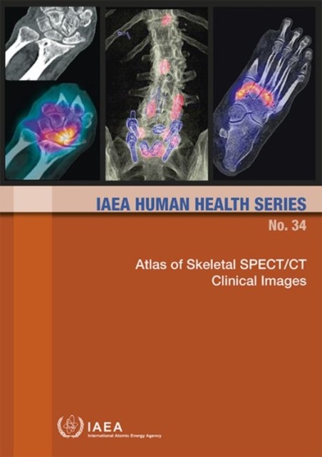 Atlas of Skeletal SPECT/CT Clinical Images, Paperback / softback Book