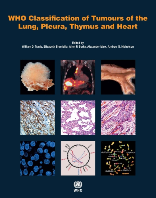 WHO classification of tumours of the lung, plura, thymus and heart, Paperback / softback Book