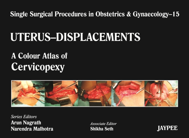 Single Surgical Procedures in Obstetrics and Gynaecology - Volume 15 - UTERUS - DISPLACEMENTS : A Colour Atlas of Cervicopexy (Purandare's), Hardback Book