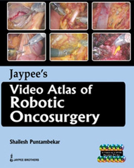 Jaypee's Video Atlas of Robotic Oncosurgery, Mixed media product Book