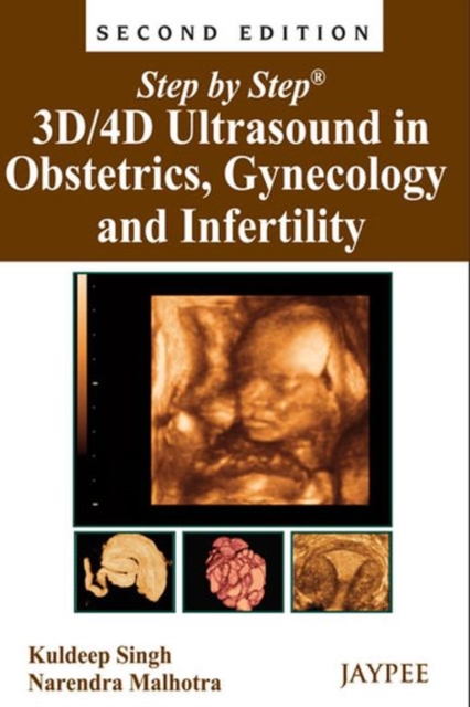 Step by Step: 3D/4D Ultrasound in Obstetrics, Gynecology and Infertility, Paperback / softback Book