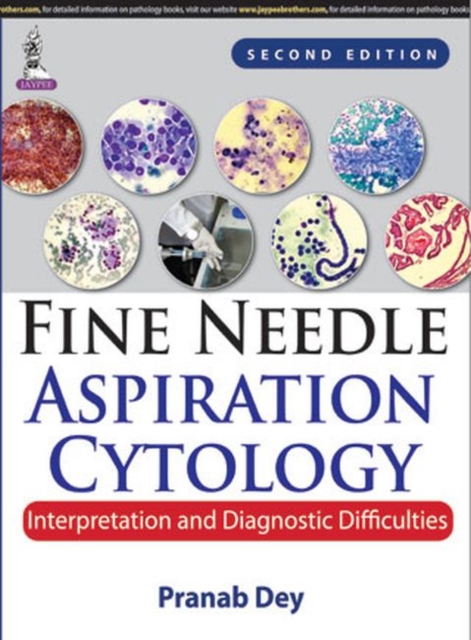 Fine Needle Aspiration Cytology: Interpretation and Diagnostic Difficulties, Hardback Book