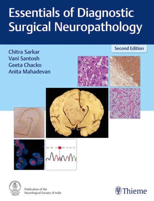 Essentials of Diagnostic Surgical Neuropathology, Hardback Book