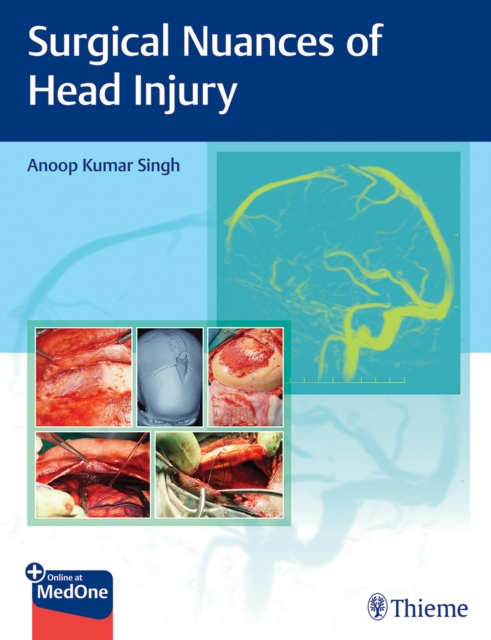 Surgical Nuances of Head Injury, Multiple-component retail product, part(s) enclose Book