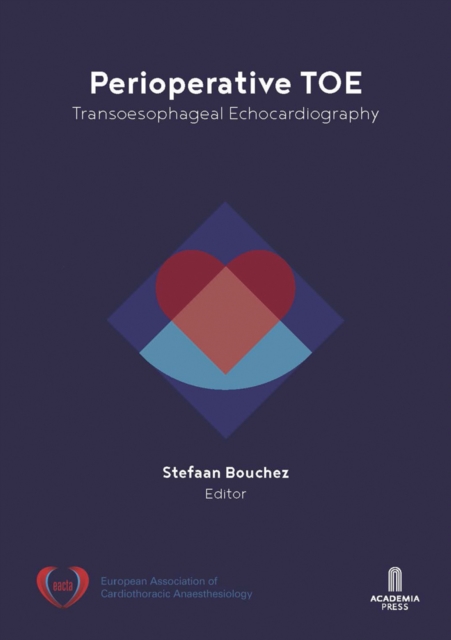 Perioperative TOE : Transoesophageal Echocardiography, Paperback / softback Book