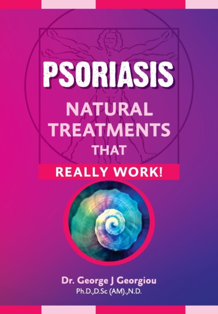 Psoriasis : Natural Treatments That Really Work!, Paperback / softback Book