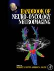 Handbook of Neuro-Oncology Neuroimaging - eBook