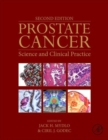 Prostate Cancer : Science and Clinical Practice - Book