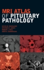 MRI Atlas of Pituitary Pathology - Book