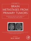 Brain Metastases from Primary Tumors, Volume 3 : Epidemiology, Biology, and Therapy of Melanoma and Other Cancers - Book