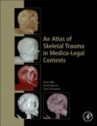 An Atlas of Skeletal Trauma in Medico-Legal Contexts - Book