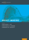 Breast Imaging - eBook