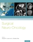 Surgical Neuro-Oncology - Book