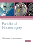 Functional Neurosurgery - Book