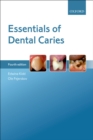 Essentials of Dental Caries - eBook