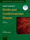Oxford Textbook of Stroke and Cerebrovascular Disease - eBook