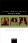 Oxford Case Histories in Lung Cancer - eBook