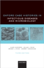Oxford Case Histories in Infectious Diseases and Microbiology - eBook