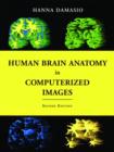 Human Brain Anatomy in Computerized Images - Book