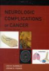Neurologic Complications of Cancer - Book