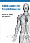 Radial Access for Neurointervention - eBook