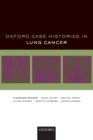 Oxford Case Histories in Lung Cancer - Book