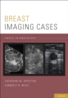 Breast Imaging Cases - eBook