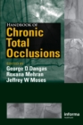 Handbook of Chronic Total Occlusions - eBook