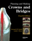 Planning and Making Crowns and Bridges - eBook