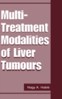 Multi Treatment Modalities of Liver Tumours - Book