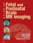 Atlas of Fetal and Postnatal Brain MR - Book